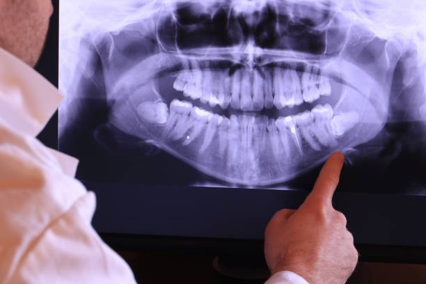 Best Emergency Dental Care for Sports Injuries in Nazareth, PA
